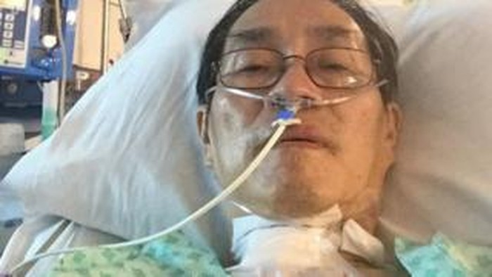 Felix Khor saat dirawat akibat Corona dan koma 43 hari (BBC News0