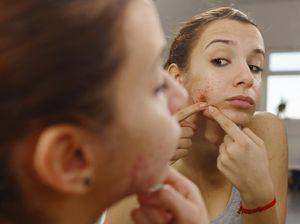 11 Cara Menghilangkan Bekas Jerawat dengan Cepat dan Alami