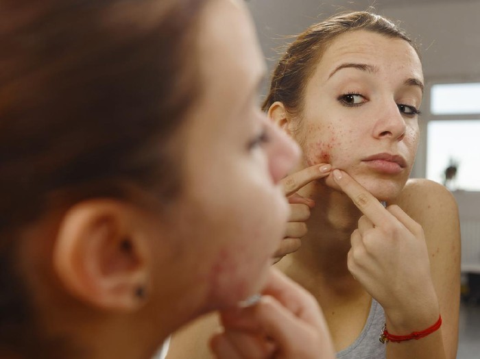 teenager portrait with acne looking in the mirror.