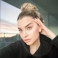 Pembedahan craniotomy berisiko membuat Emily Sears kehilangan kemampuannya berbicara. Untuk mencegah hal tersebut terjadi, Emily harus dioperasi dalam keadaan sadar, atau hanya dibius lokal. Foto: Instagram/@emilysears