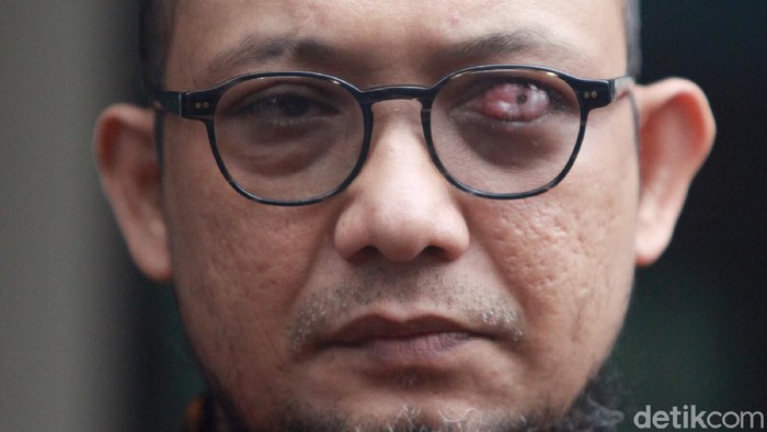 Momen Novel Baswedan Sambangi Komisi Kejaksaan Penyidik KPK Novel Baswedan memenuhi panggilan Komisi Kejaksaan RI (Komjak RI) hari ini soal polemik tuntutan 1 tahun penjara terhadap dua terdakwa kasus teror terhadapnya.