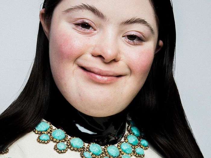 Remaja Down Syndrome Jadi Model Gucci