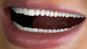 Senyum dengan gigi yang putih bersih tapi kok sepanjang ini. (Foto: Brightside)