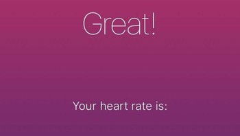 Tidak ada detak jantung. Foto: Bored Panda