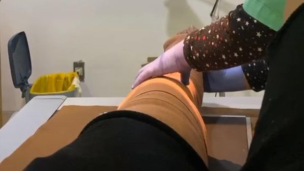 sammy simorangkir jalani operasi kaki