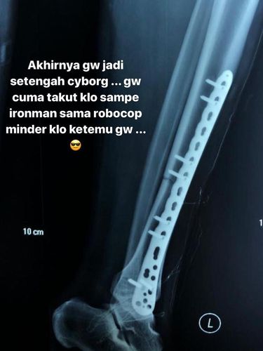 GAMBAR KAKI SAMMY SIMORANGKIR