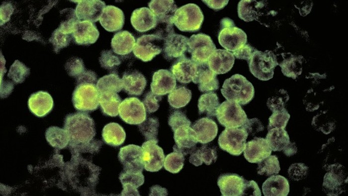 Infeksi otak langka yang diakibatkan amoeba pemakan otak ditemukan di Florida