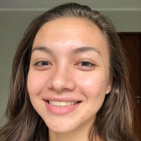 Jerawat dan bekas jerawatnya terpampang nyata. Angela pun memperlihatkan giginya yang kuning. Unggahannya tersebut diakuinya sebagai bentuk penerimaan atas dirinya sendiri.  Foto: dok. Instagram