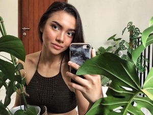 Foto: Pesona Angela Gilsha yang PD Pamer Wajah Berjerawat dan Gigi Kuning