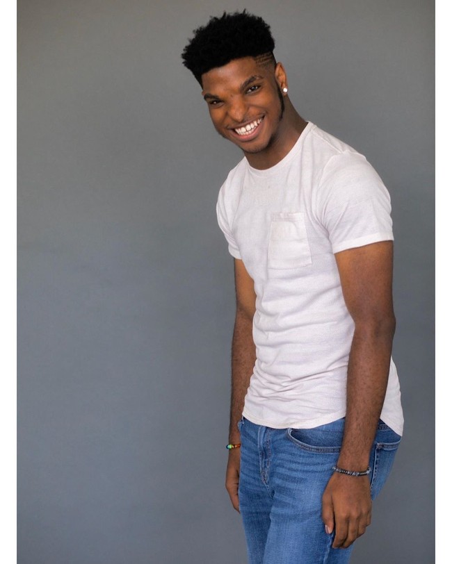 Setelah menandatangani kesepakatan dengan We Speak, sang ibu mengatakan kepada Justin bahwa itu semua adalah berkat dari keunikan bentuk hidungnya. Sejak lahir, Justin memang memiliki bentuk hidung yang tidak sempurna atau sumbing. Kondisi tersebut dinamakan Displasia Frontonasal. Foto: Instagram @_justinstewart