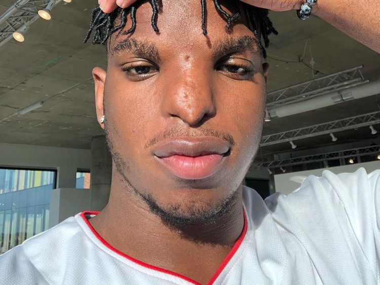 Cowok Ini Nggak Nyangka dengan Bentuk Hidung Begini Bisa Jadi Model
