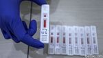 Keren! Ini Lho Alat Rapid Test Made In Indonesia