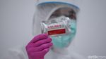 Keren! Ini Lho Alat Rapid Test Made In Indonesia