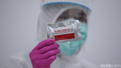 Keren! Ini Lho Alat Rapid Test Made In Indonesia