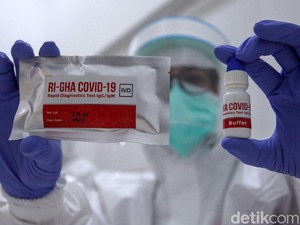 Pandemi Corona dan Babak Baru Dunia Riset Indonesia