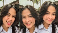Penampilan Dara Arafah sebelum melakukan operasi. Dok. Instagramdaraarafah