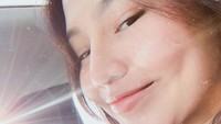 Dara Arafah pun sudah meminta izin orang tuanya untuk melakukan operasi pada hidungnya yang menghabiskan Rp 100 juta itu. Dok. Instagramdaraarafah