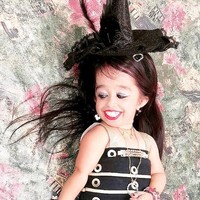 Jyoti memang dilahirkan dengan Primordial Dwarfish, kondisi langka yang menyebabkan tubuhnya sangat kecil dan berbeda dari orang-orang pada umumnya. Dengan kondisinya itu, Jyoti tidak dapat pergi ke luar rumah sendirian karena takut orang-orang akan menginjaknya. Foto: Instagram @jyoti_amge