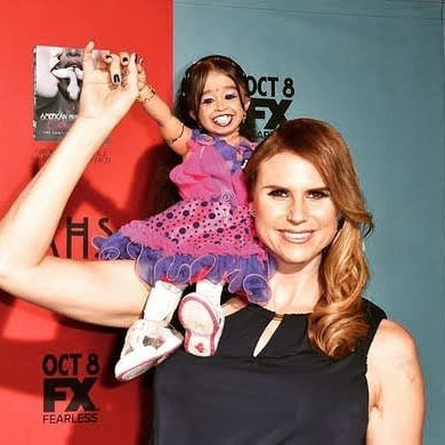 Saat lahir berat Jyoti hanya 1,3 kg. Para staf medis bahkan mengatakan bahwa kemungkinan besar Jyoti hanya bisa hidup selama beberapa jam saja. Namun hingga saat ini dirinya bisa hidup dan bertahan. Foto: Instagram @jyoti_amge