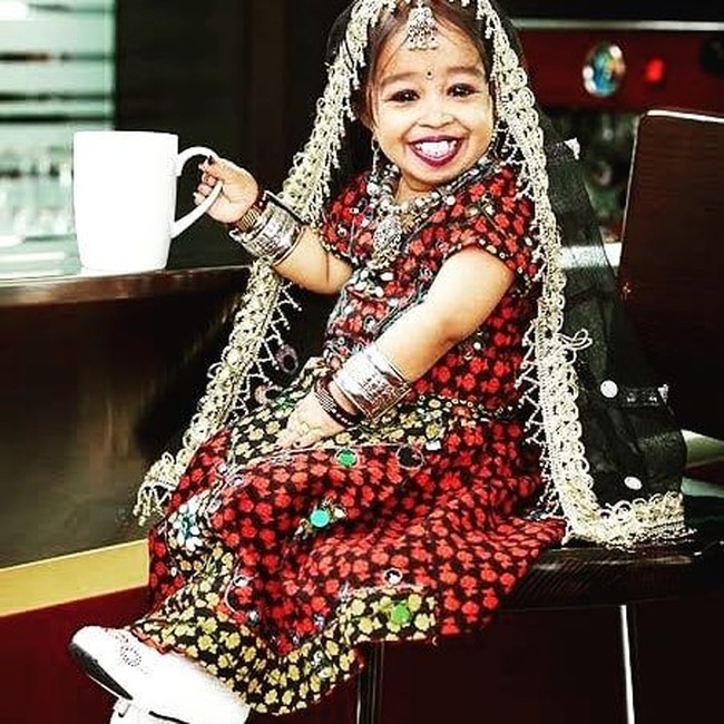 Saat bayi Jyoti berkembang seperti bayi-bayi biasa pada umumnya, sampai ketika Jyoti beranjak balita barulah pihak keluarga meyadari ada sesuatu yang tidak beres.  Foto: Instagram @jyoti_amge