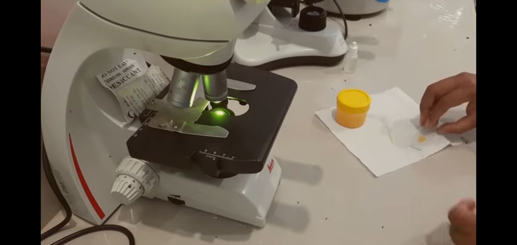telur infertil mikroskop