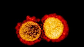 Indonesia sendiri berusaha membuat vaksin COVID-19 dengan lembaga Eikjman dan universitas-universitas ternama seperti UI dan Unpad. Foto: NIAID