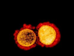 Tampilan Virus Corona di Bawah Mikroskop, Cantik Tapi Bahaya