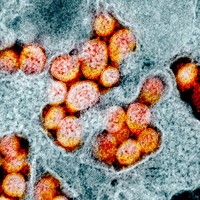 Virus Corona terbaru atau Sars-Cov-2 yang menjadi penyebab COVID-19 memang berbahaya. Tapi tampilannya di bawah mikroskop bisa sangat bertolak belakang.