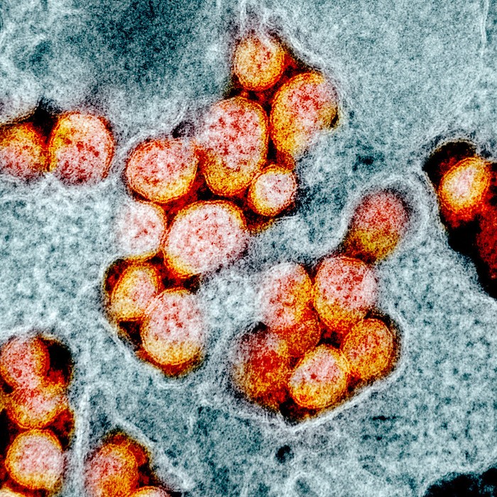 Virus Corona terbaru atau Sars-Cov-2 yang menjadi penyebab COVID-19 memang berbahaya. Tapi tampilannya di bawah mikroskop bisa sangat bertolak belakang.