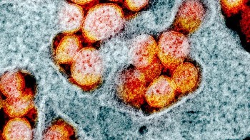 Hingga saat ini, masih dilakukan penelitian lebih lanjut untuk menemukan vaksin atau obat yang tepat untung melawannya. Foto: NIAID