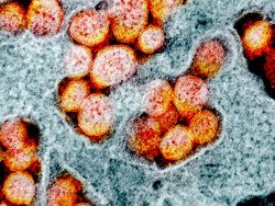 Tampilan Virus Corona di Bawah Mikroskop, Cantik Tapi Bahaya