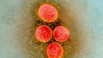 Virus Corona baru sendiri mulai merebak diperkirakan pada akhir Desember di Wuhan, China. Foto: NIAID