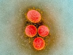 Tampilan Virus Corona di Bawah Mikroskop, Cantik Tapi Bahaya