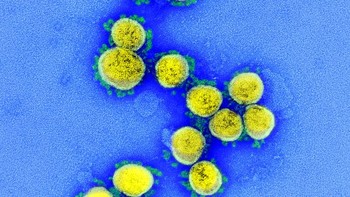 Kebayang nggak sih kalau virus yang berbahaya ini bisa tampil cantik di bawah mikroskop? Foto: NIAID