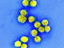 Tampilan Virus Corona di Bawah Mikroskop, Cantik Tapi Bahaya