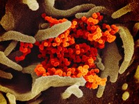 Virus Corona terbaru atau Sars-Cov-2 yang menjadi penyebab COVID-19 memang berbahaya. Tapi tampilannya di bawah mikroskop bisa sangat bertolak belakang.