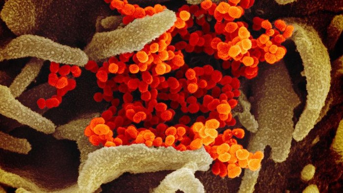 Tampilan Virus Corona di Bawah Mikroskop, Cantik tapi Berbahaya Virus Corona terbaru atau Sars-Cov-2 yang menjadi penyebab COVID-19 memang berbahaya. Tapi tampilannya di bawah mikroskop bisa sangat bertolak belakang.