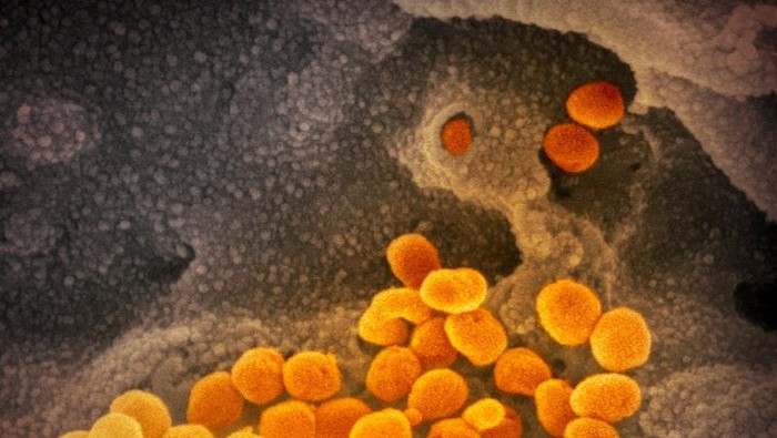 Tampilan Virus Corona di Bawah Mikroskop, Cantik tapi Berbahaya Virus Corona terbaru atau Sars-Cov-2 yang menjadi penyebab COVID-19 memang berbahaya. Tapi tampilannya di bawah mikroskop bisa sangat bertolak belakang.