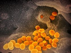 Tampilan Virus Corona di Bawah Mikroskop, Cantik Tapi Bahaya