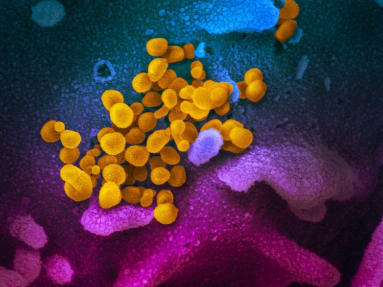 Tampilan Virus Corona di Bawah Mikroskop, Cantik tapi Berbahaya Virus Corona terbaru atau Sars-Cov-2 yang menjadi penyebab COVID-19 memang berbahaya. Tapi tampilannya di bawah mikroskop bisa sangat bertolak belakang.