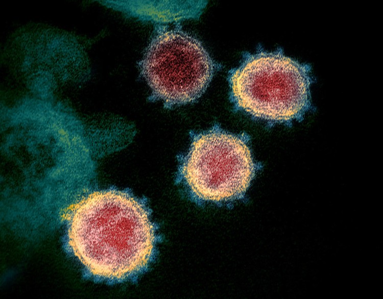 Virus Corona terbaru atau Sars-Cov-2 yang menjadi penyebab COVID-19 memang berbahaya. Tapi tampilannya di bawah mikroskop bisa sangat bertolak belakang.