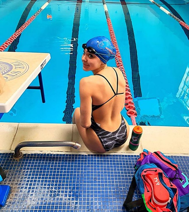 Kehilangan penglihatan sempat membuat Anastasia kesulitan berlatih untuk mengasah kemampuannya. Orang yang tidak mengenalnya mungkin akan mengira kalau dia anak ceroboh. Foto: Instagram/@anastasia_k_p