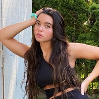 Menurut National Eye Institute, diperkirakan 1 dari 8.000 - 10.000 orang menderita penyakit ini yang bisa muncul saat kecil maupun dewasa. Foto: Instagram/@anastasia_k_p