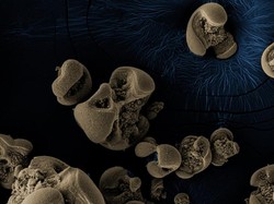 Bakteri Pemakan Logam Keluarkan Emas, Ilmuwan Terkejut!