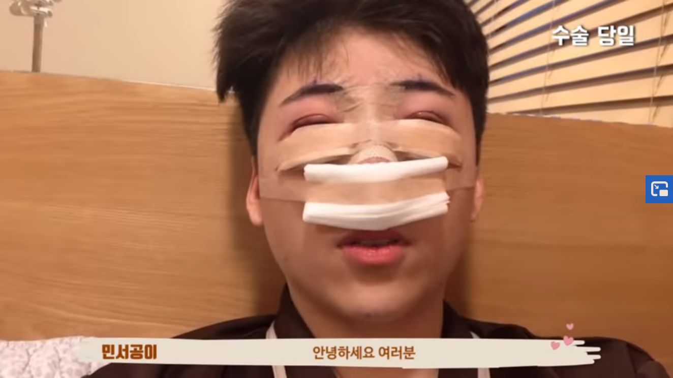 Kim Min Seo Operasi Plastik untuk MIrip Park Bo Gum