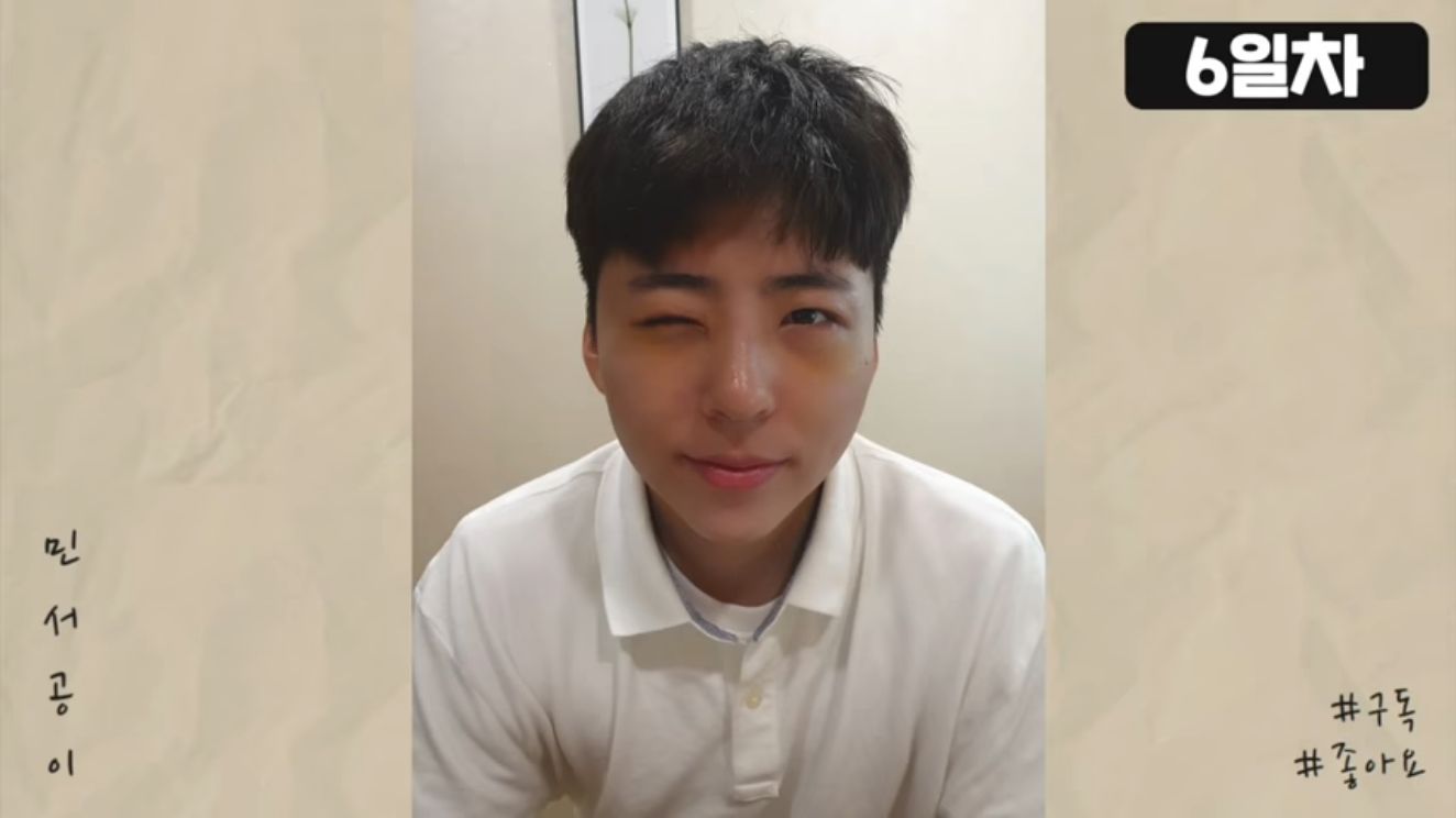 Kim Min Seo Operasi Plastik untuk MIrip Park Bo Gum