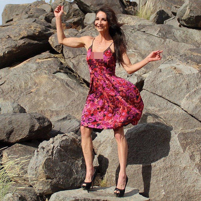 Lynn mengaku ingin menyadarkan wanita akan pentingnya gaya hidup sehat untuk mencegah penyakit di usia senja. Menurut Lynn, tips olahraga dan menjaga pola makan yang sering dibagikannya baik untuk mencegah kanker. Untuk kanker, satu hal yang lebih penting dari pada menjaga berat badan adalah tidak merokok. Karena kelebihan berat badan menyebabkan inflamasi dan ketidakseimbangan hormon. Kalau kamu obesitas kamu risikomu tinggi untuk 12 jenis kanker, tuturnya. Foto: Instagram @lynnmontoyafitness