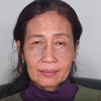 Video berjudul Resepsi Pernikahan NENEK VIRAL! Umur 60 TAHUN Jadi PENGANTIN itu menunjukkan bagaimana kekuatan makeup dapat mengubah wajah seseorang. Inilah wajah sebelum didandani. Wajah nenek dua cucu itu sudah terlihat kendur dengan banyak flek hitam.  Foto: Youtube