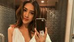 Anya Geraldine Ngaku Dulu Bohay Mirip Ayam Kalkun, Sekarang Gimana?
