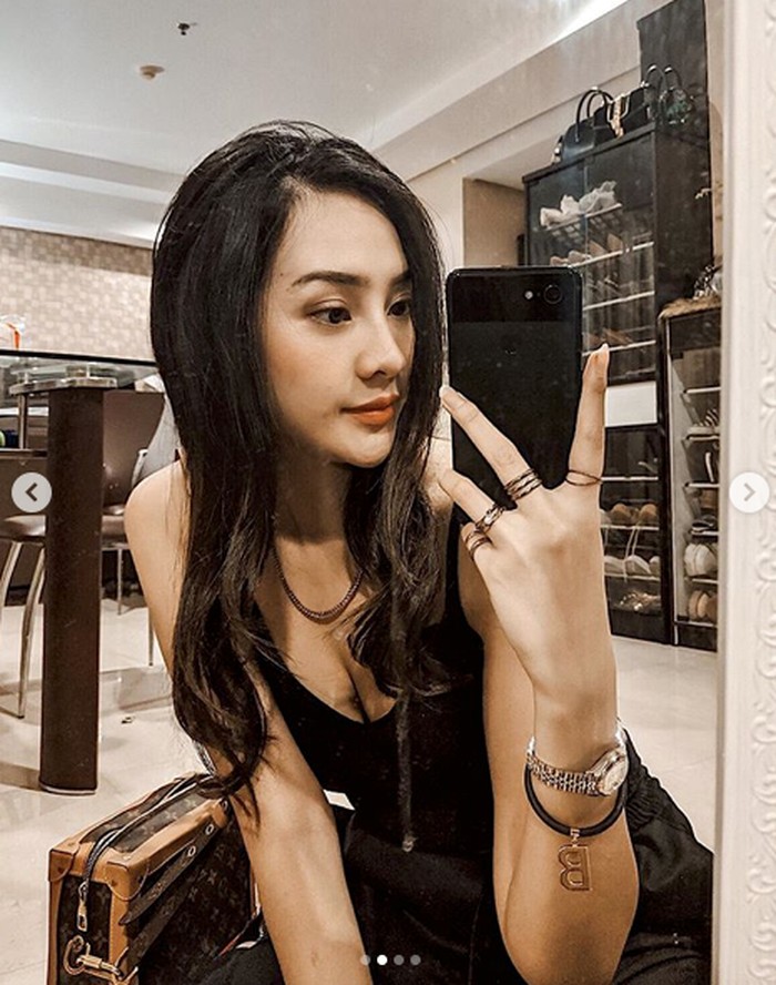 Anya Geraldine Ngaku Dulu Bohay Mirip Ayam Kalkun Sekarang Gimana